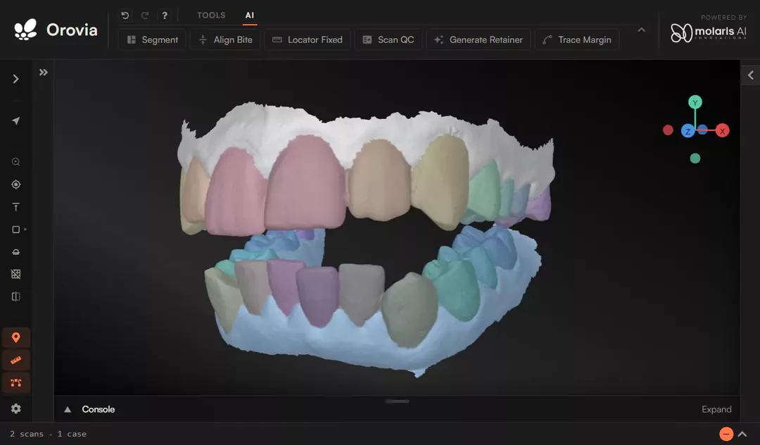 Orovia 3D viewer showing segmented upper and lower dental arches, with tools for scan QC, bite alignment, and margin tracing