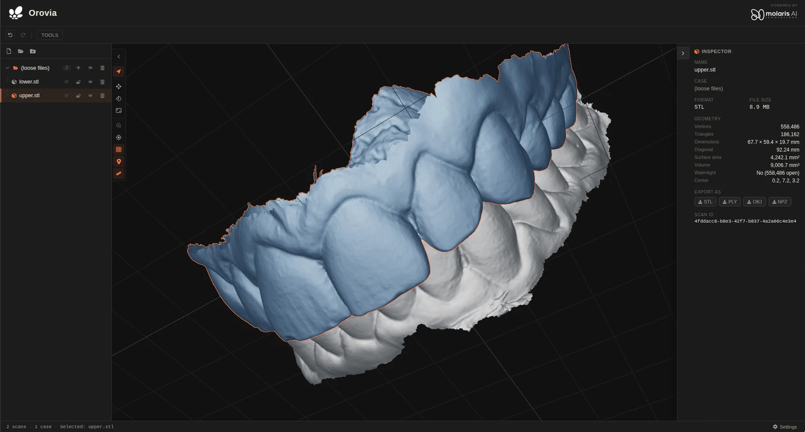 Orovia 3D viewer showing upper and lower dental scans with margin highlighting, mesh inspector and export options